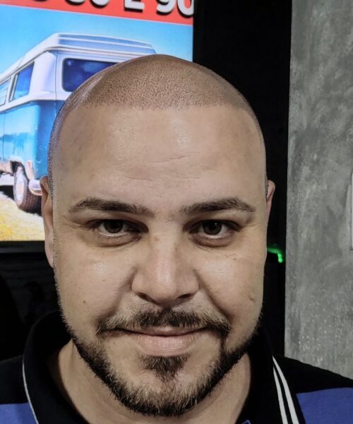 Cliente Curso resultado micropigmentação capilar kauai studio 3